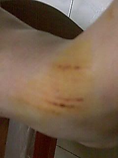 ii kena miio leg..
